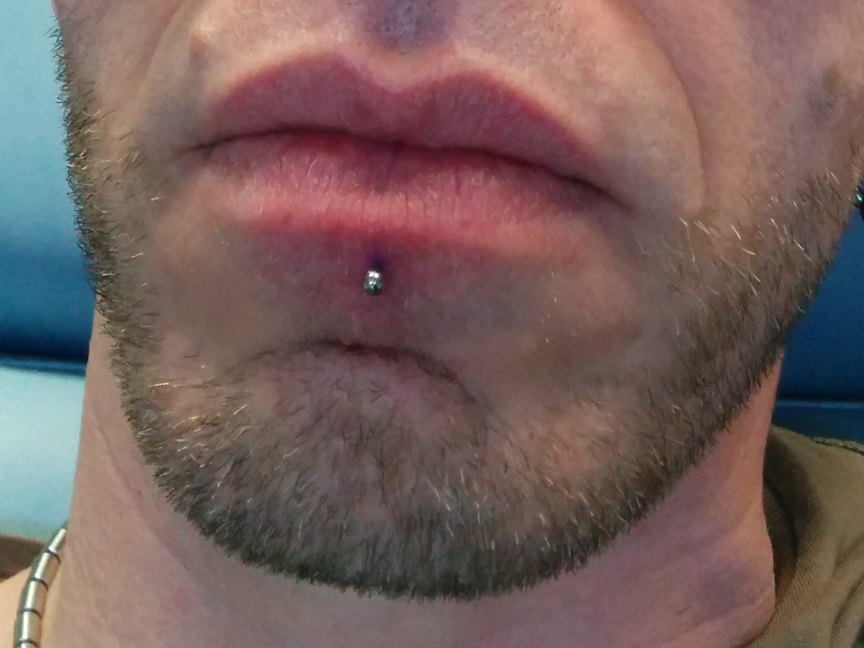 Fertig